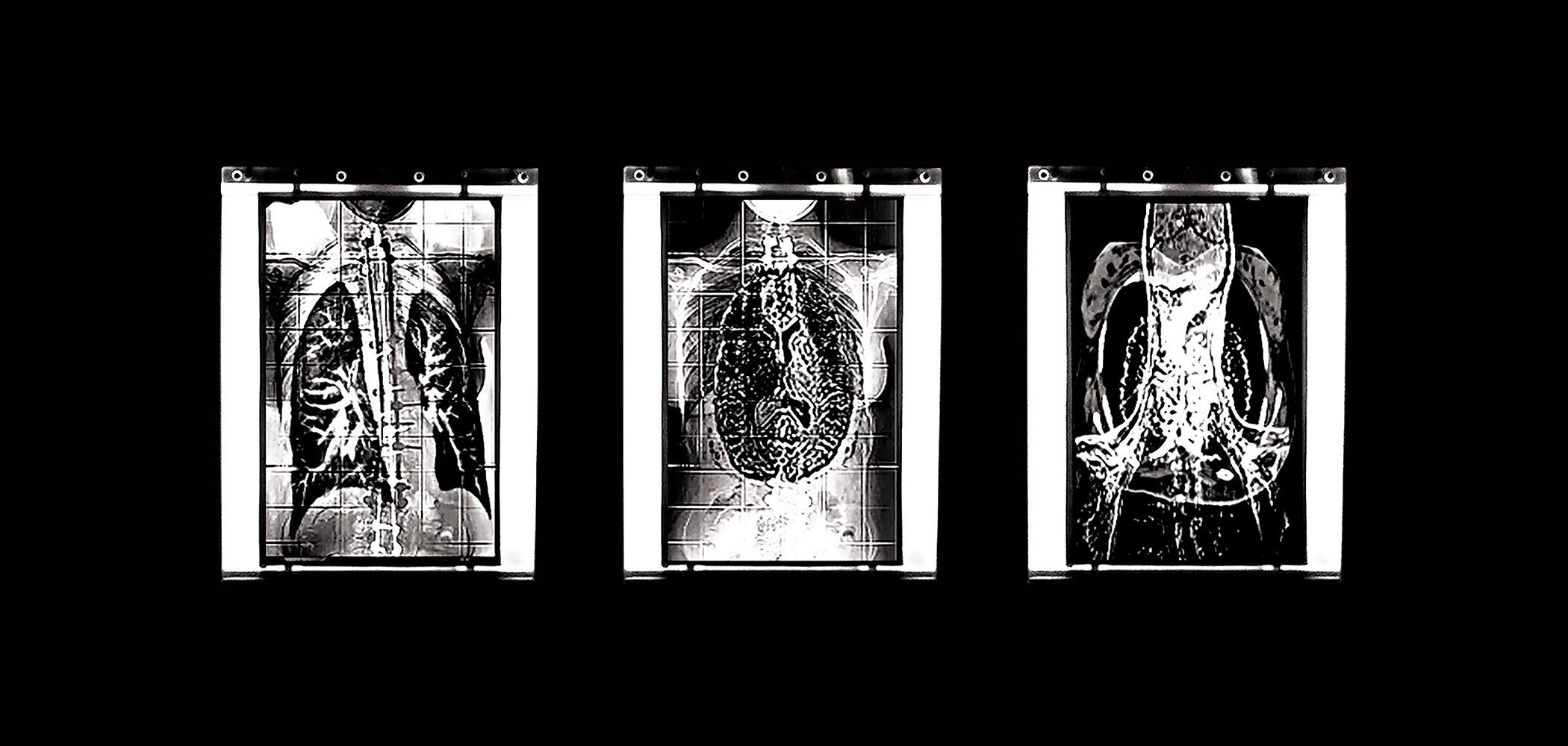 A triptych photograph captures a bio-transmedia art installation and hacked medical lightbox, sequentially exhibiting a fragmented and superimposed rendition of the author’s X-rays and MRI scans, defying clinical interpretation.