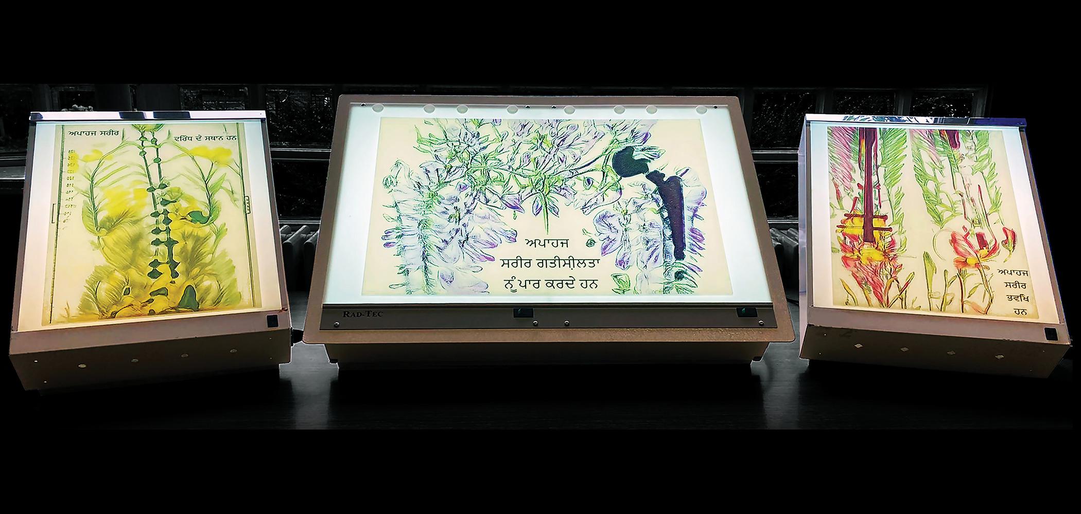 Three medical lightboxes exhibiting a colorful amalgam of X-rays with prostheses and botanical designs set against a monochrome background, each featuring Punjabi script celebrating the wholeness of disabled bodies.