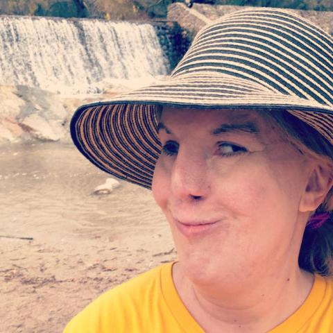A woman wearing a broad-brimmed straw hat and yellow T shirt smiles by a waterfall. She is light-skinned with blonde hair pulled back and has faint scars around her mouth.