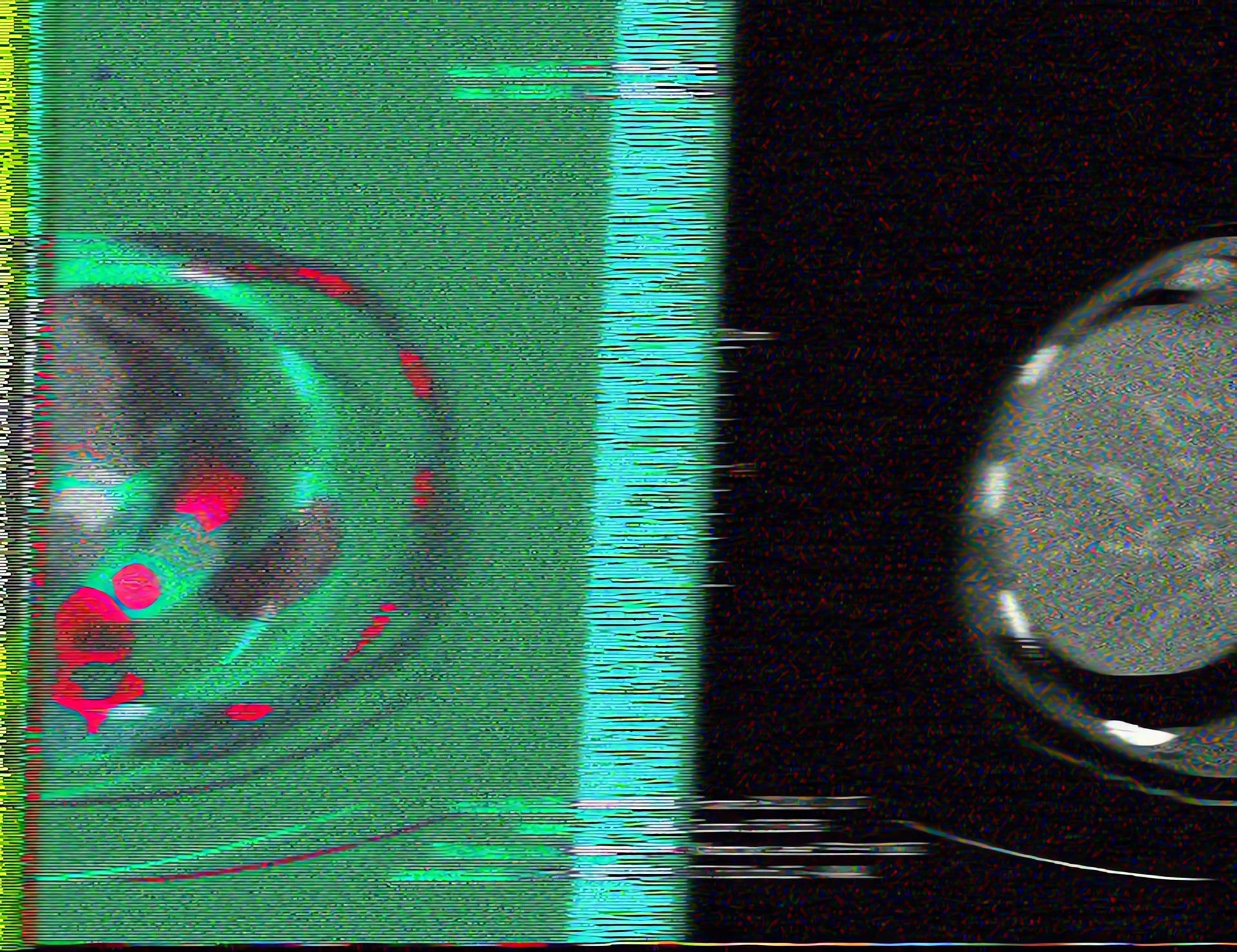 A glitchy CT scan. The left half is green with red areas, and the right is black and white.